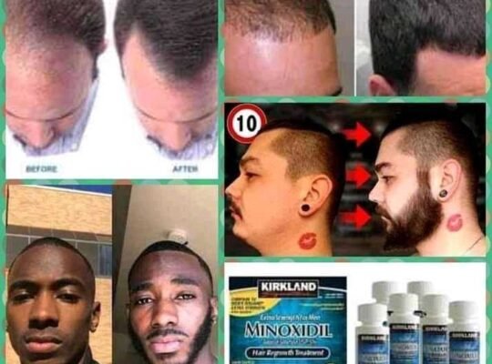 KIRKLAND MINOXIDIL