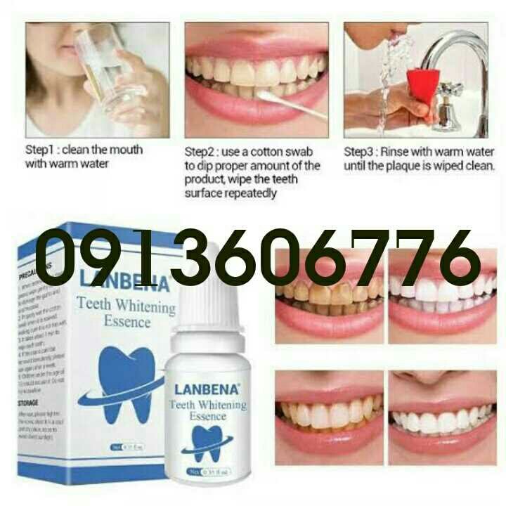 Ethiopia lanbena teeth whitening