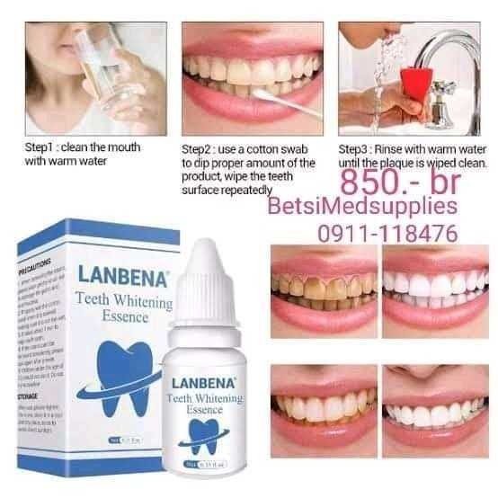 Lanbena – Teeth whitening. ለበለዘና ለጠቆረ ጥርስ ንጣትና ውበት