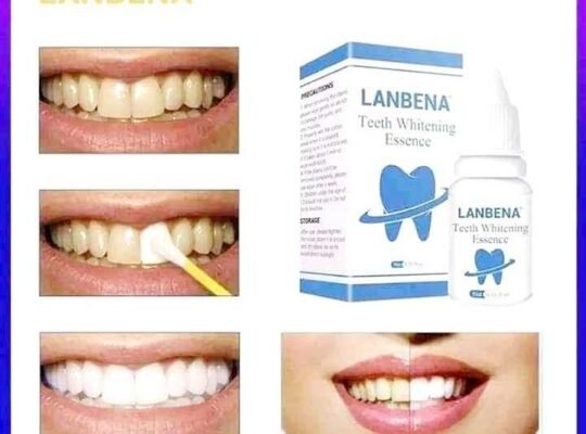 Lanbena – Teeth whitening. ለበለዘና ለጠቆረ ጥርስ ንጣትና ውበት