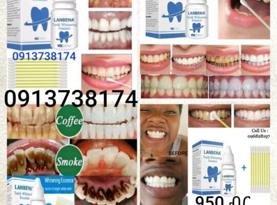 Lanbena teeth whiteing