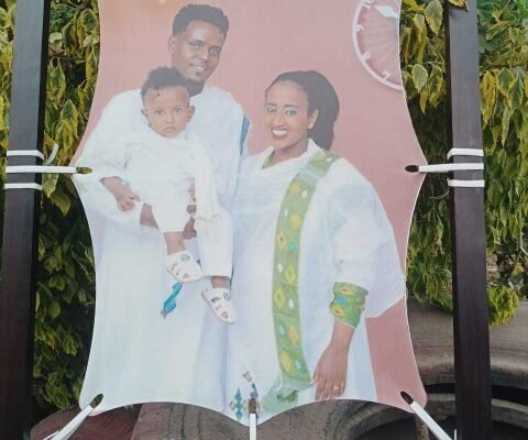 የቆዳ ላይ ፎቶ