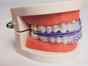 teeth alignment