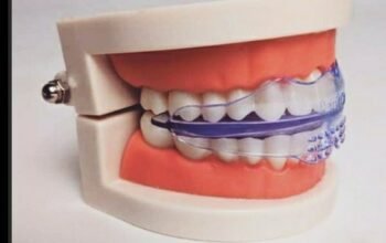 teeth alignment